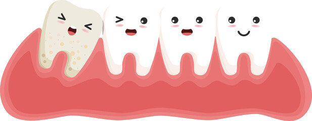 Wisdom tooth push other tooth. Impacted wisdom tooth character pushing adjacent teeth causing inflammation, toothache, gum pain.