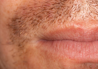 Fototapeta premium Hair on the skin of a man's face. Macro
