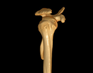 CT Shoulder 3D