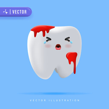 3D Realistic Bleeding Teeth Vector Illustration. Suitable for Children Dentistry Clinic Poster Design.