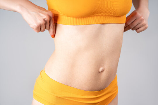 Skinny belly after tummy tuck, plastic surgery concept