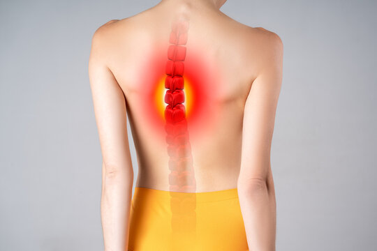 Intervertebral spine hernia, pain between the shoulder blades, woman suffering from backache at home, spinal disc disease