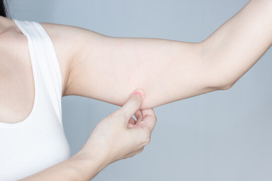 Woman is pulling underarm muscle with excess of cellulite. Fat, flabby and overweight