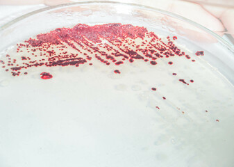 Red colonies of photosynthetic bacteria on culture medium agar. Streak plate technique. Microbiology concect