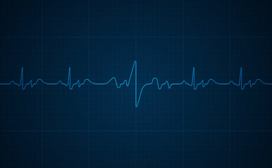Emergency ekg monitoring. Blue glowing neon heart pulse. Heart beat. Electrocardiogram
