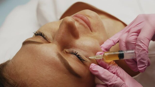 Injections of blood plasma in the face and head.