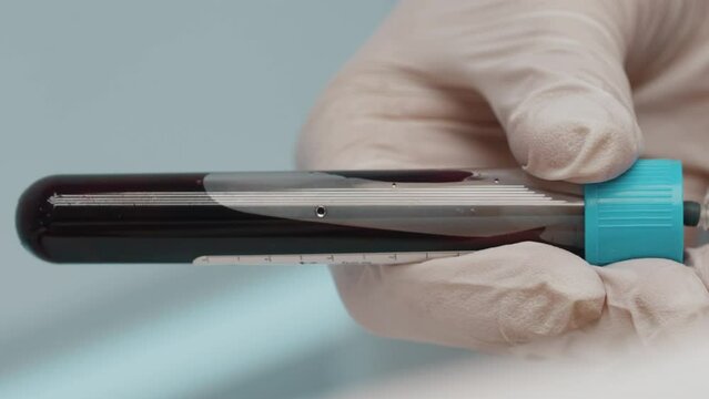 Taking a blood test.