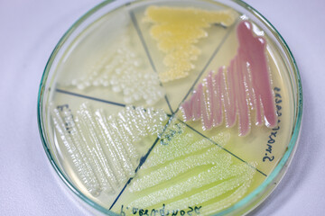 The fungus and bacteria is used for composting, Used for agriculture.