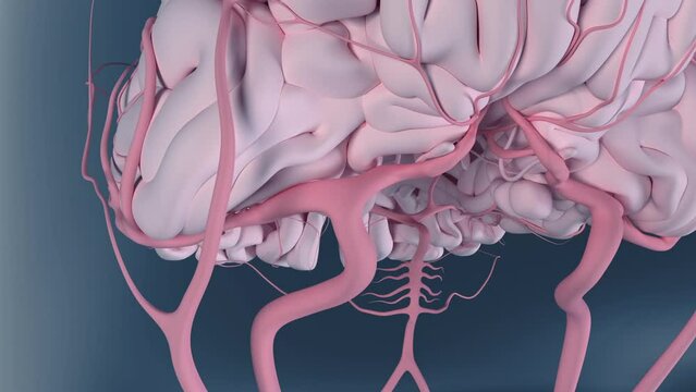Cerebral Arteries Blood Flow Blocked by a Clot