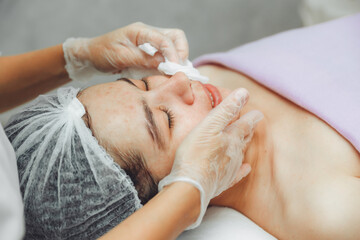 Obraz na płótnie Canvas A cosmetologist cleanses the skin of a beauty salon client before the procedure and facial massage. The concept of beauty and health. cosmetology. pimple-covered skin