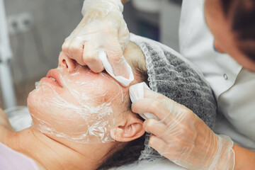 A cosmetologist in a beauty salon does a mechanical cleaning of a woman's face with his own hands. acne removal. heavily polluted face.