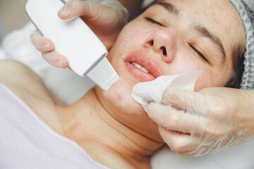 Fototapeta premium Ultrasonic cosmetic scrubber. Facial cavitation procedure. Salon skin care procedure. Professional hardware peeling. Acne removal. contaminated person
