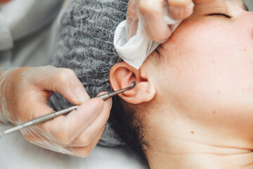 A young girl is lying on a couch during cosmetic procedures, over which a cosmetologist squeezes out fat deposits and pimples with a special metal tool.ear cleaning