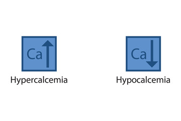 Hypercalcemia and Hypercalcemia – Calcium Ca excess and deficit electrolyte disorder, blue arrow icon vector illustration