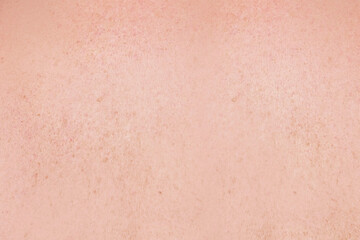 Close-up on woman skin texture. Skin care concept.