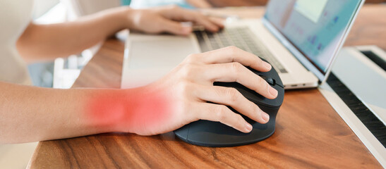 Fototapeta premium woman hand using computer ergonomic mouse, prevention wrist pain because working long time. De Quervain s tenosynovitis, Intersection Symptom, Carpal Tunnel Syndrome or Office syndrome concept