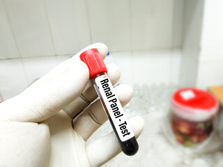 Blood sample for Renal Panel test. To diagnosis kidney disease