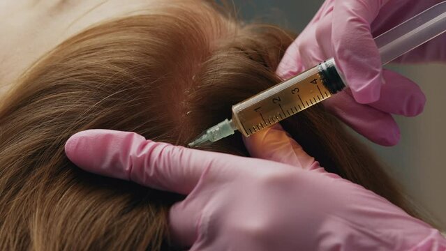 Plasma treatment, plasmolifting or PRP method point the introduction of the patient's own plasma enriched with platelets, in the problem areas of the skin.