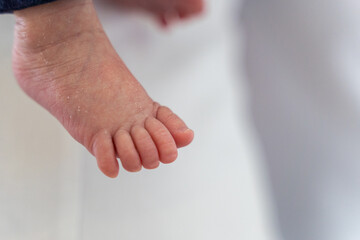 Right foot of a 2-month-old baby boy