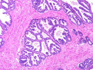 Histology of human tissue, show  epithelial tissue and connective tissue with microscope view  from...
