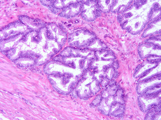 Histology of human tissue, show  epithelial tissue and connective tissue with microscope view  from laboratory (not Illustration Designation)