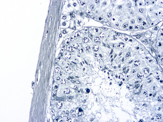 Histology of human tissue, show  epithelial tissue and connective tissue with microscope view  from laboratory (not Illustration Designation)