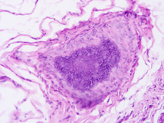 Histology of human tissue, show  epithelial tissue and connective tissue with microscope view  from...