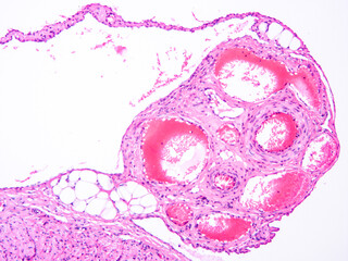 Histology of human tissue, show  epithelial tissue and connective tissue with microscope view  from...