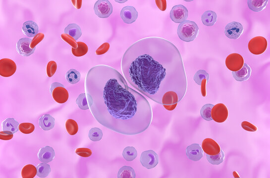 Prolymphocytic Leukemia (PLL) cancer cells - closeup view 3d illustration