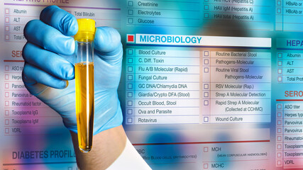 Microbiologist holding urine sample tube and background microbiology testing request form. Doctor...