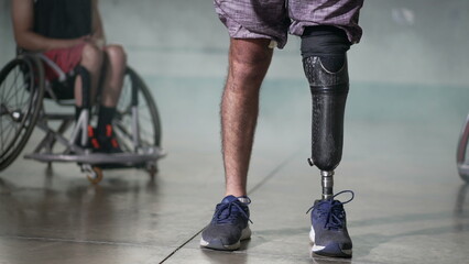 Disabled person standing with prosthetic leg. Person on wheelchair in background. Determination and motivation concept