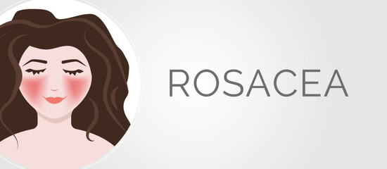 Rosacea Background Banner Illustration