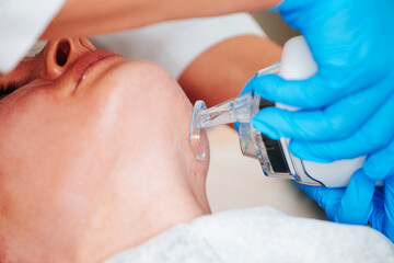 Performing laser resurfacing using an ablative laser on the skin of a patient face in an aesthetic medicine center