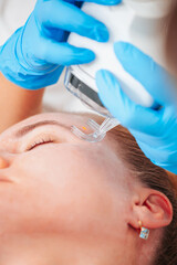 Performing laser resurfacing using an ablative laser on the skin of a patient face in an aesthetic medicine center