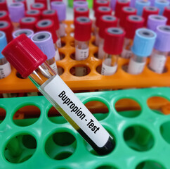 Blood sample for Bupropion(drug) test, to set therapeutic range antidepressant drug indicated for...