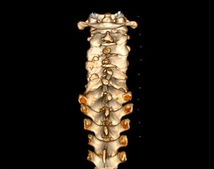 CT scan of C-Spine or Cervical spine 3D rendering .