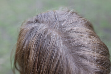 Drops of water on child hair closeup