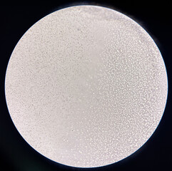 Red blood cell non agglutination Crossmatching compatible donor.