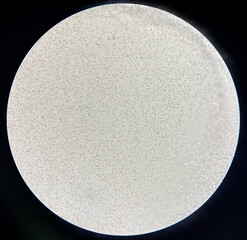 Red blood cell non agglutination Crossmatching compatible donor.