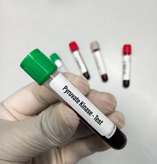 Blood samples for Pyruvate Kinase test for pyruvate kinase deficiency. It's  an enzyme found in red blood cells.