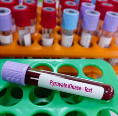 Blood samples for Pyruvate Kinase test for pyruvate kinase deficiency. It's  an enzyme found in red...