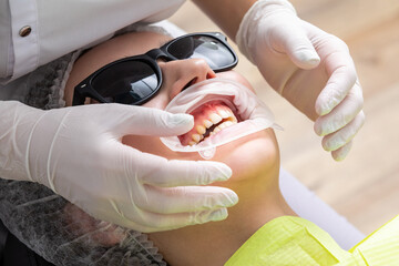 Patient with cheek retractor lying in dentist office