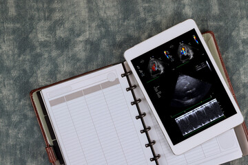 Using a digital tablet device, the doctor checks results of echocardiography ultrasound examination heart to prescribe course action that is effective