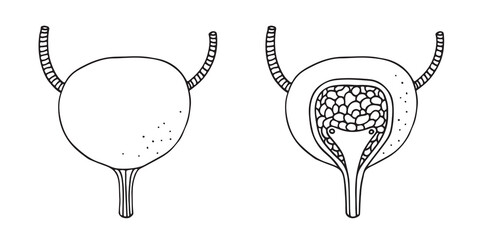 Vector illustration of a human bladder with incision