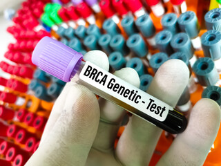 BRCA1 and BRCA2 are two genes that are important to fighting cancer called tumor suppressor genes.