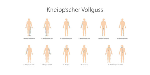 Schaubild Plakat Kneipp'sche Güsse nach Sebastian Kneipp - Vollguss mit deutscher Beschriftung