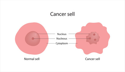 The structure of the cancer cell. Vector illustration.