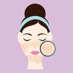 Beautiful Young Smart Lady With Couperose (Rosacea) On Face Icon Against Pink Background.