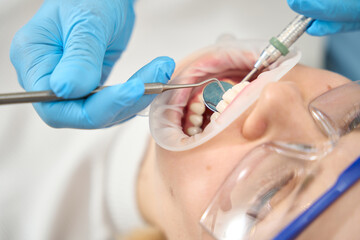 Close-up of dental treatment for young woman in dentist office