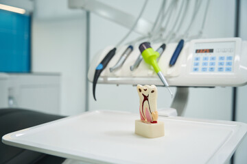 Close-up of tooth model with root canals and caries